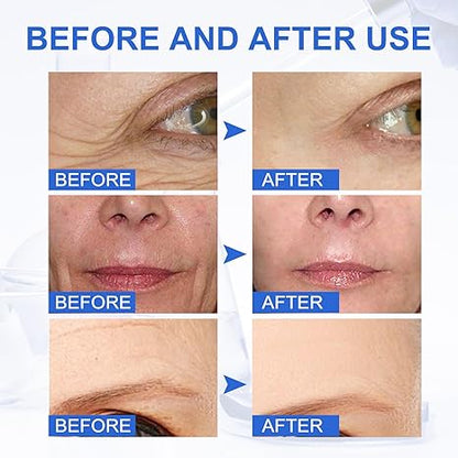 Tiworld™ Botox Stock Solution